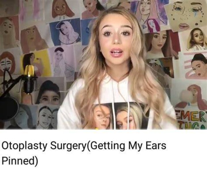 
Emery Bingham Ear Surgery At La Belle Vie Cosmetic Center 