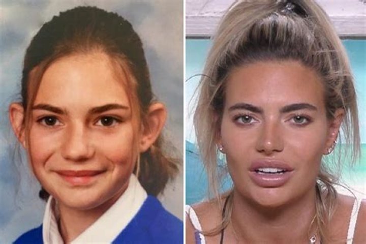 
Megan Barton Hanson Before Plastic Surgery Photos- Love Island Star Details To Know 