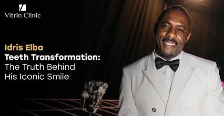 Why Is Idris Elba Teeth So White? Fans Suspect Dental Surgery Or Fake Tooth